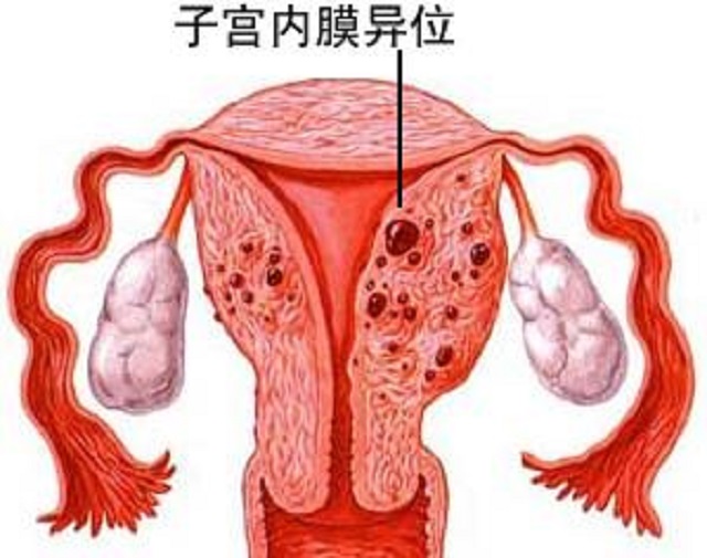 输卵管通畅，排卵正常的育龄妇女为什么久久怀不上？有可能是因为