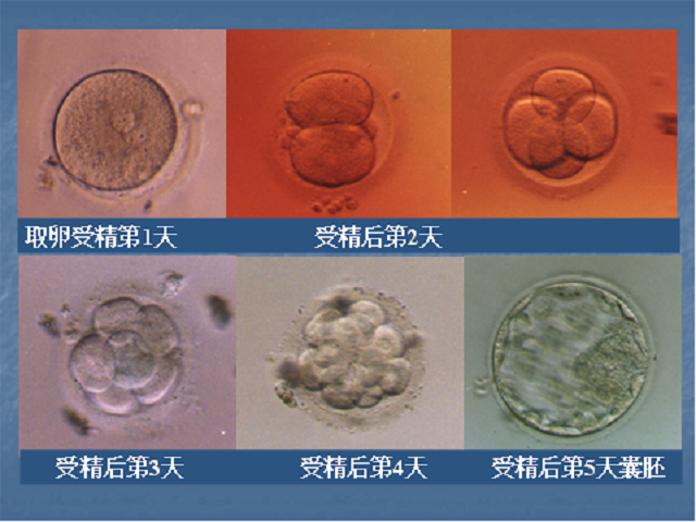囊胚培养有风险吗？