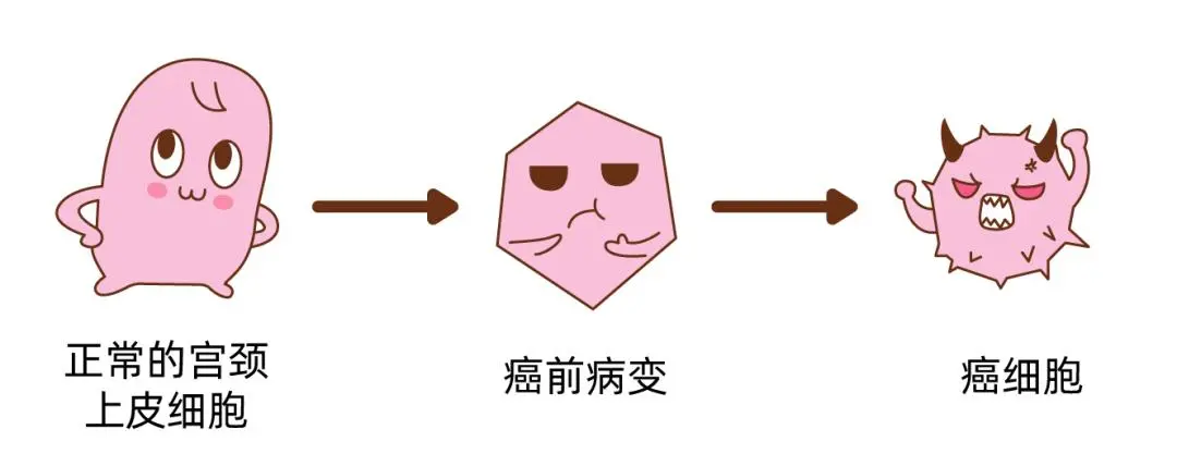 试管前常规检查，竟查出差点患癌