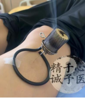 广西壮族自治区生殖医院中医科温针灸防落灰器和葫芦灸具院内议价采购公告